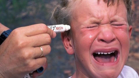 Junge weint bei Behandlung eines Mückenstichs 