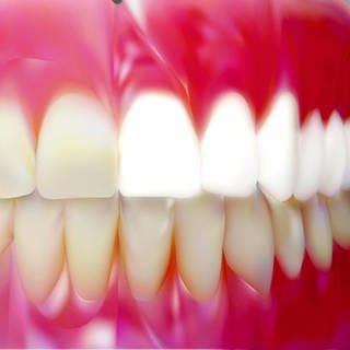 Beim Bleaching werden mittels Chemie Zähne weißer
