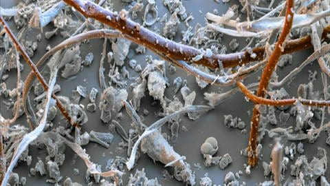 Hausstaub unter dem Mikroskop: Eine Vielzahl an Partikeln und Stoffen