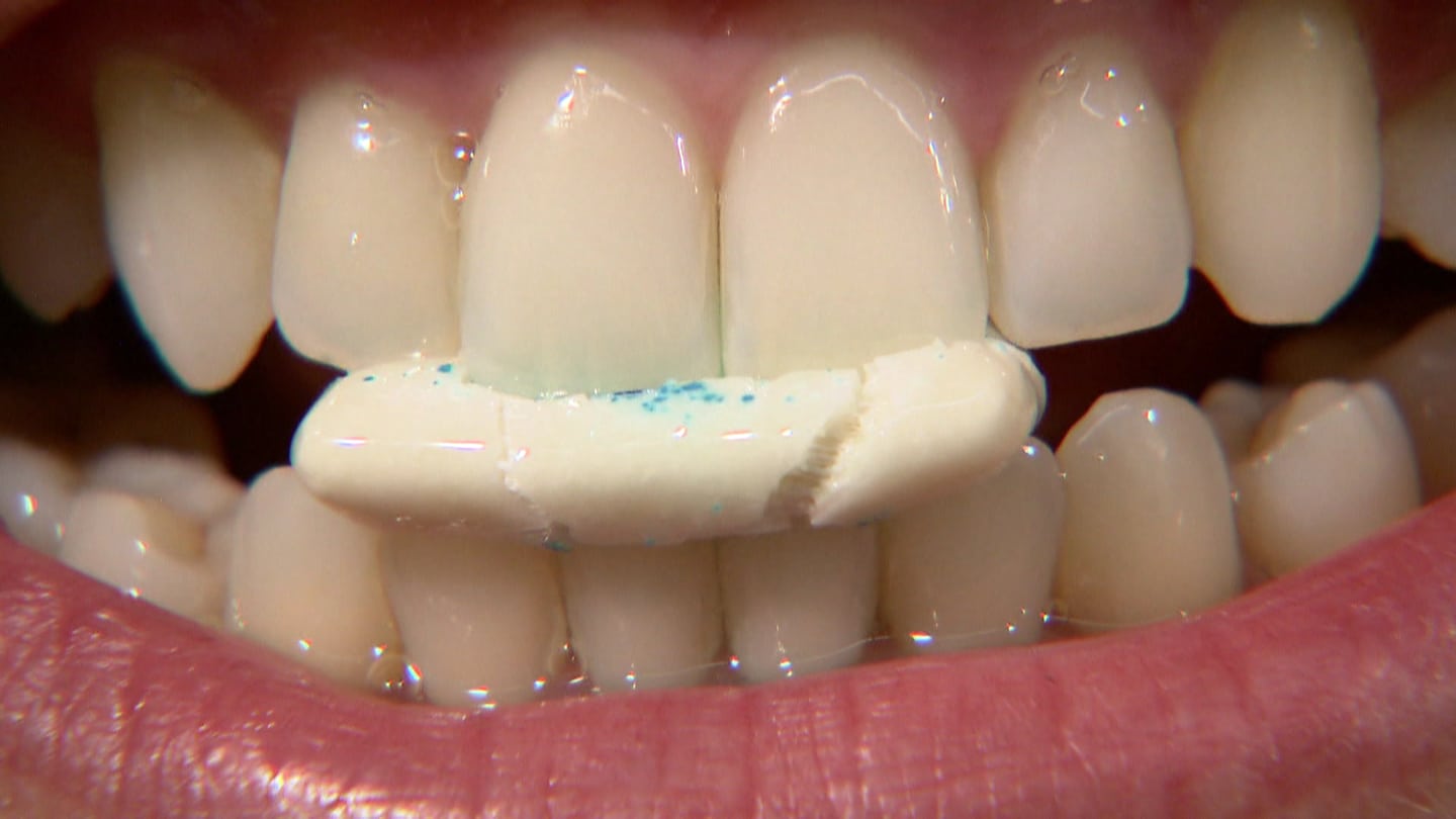 Kaugummi regt die Speichelproduktion im Mund an und unterstützt so die Zahnpflege