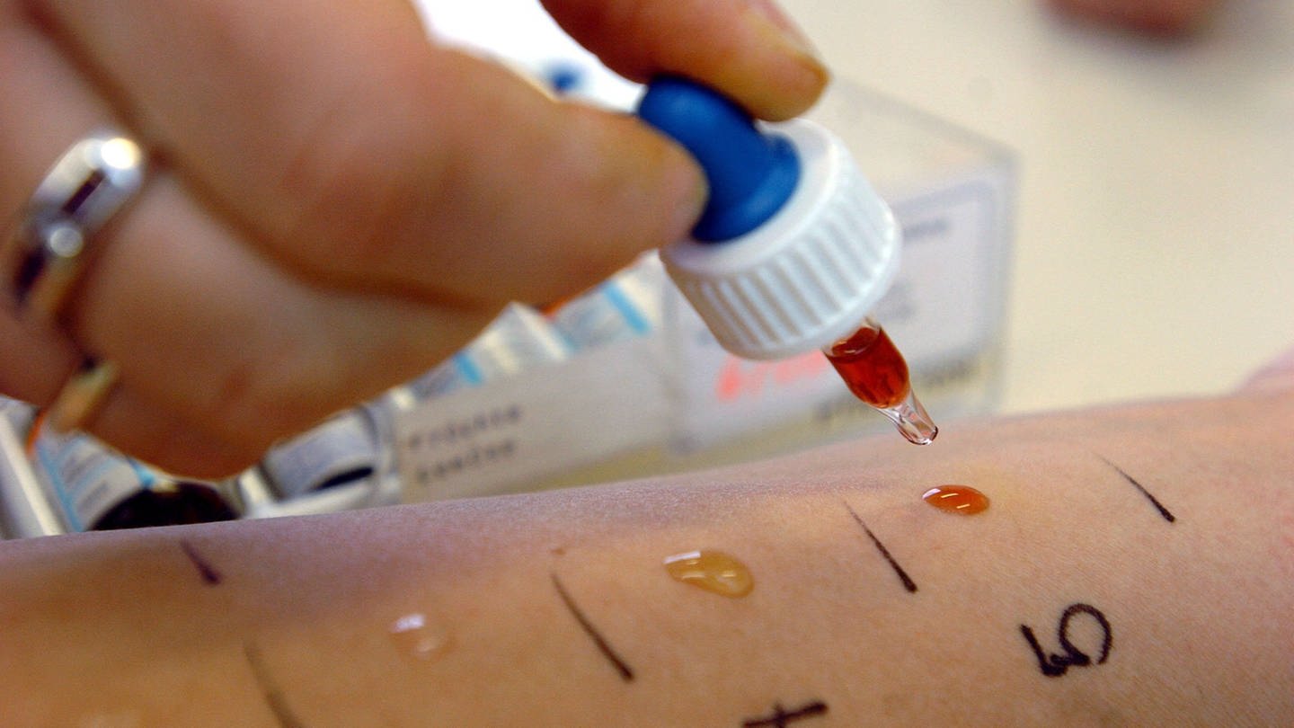 Bei einem Allergie-Test werden Substanzen auf die Haut einer Patientin aufgetragen.