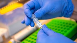 Eine Labormitarbeiterin im DNA-Labor des Bayerischen LKA bereitet eine DNA-Probe für die molekularbiologische Analyse vor