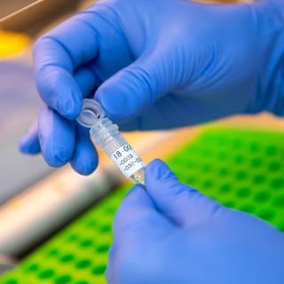 Eine Labormitarbeiterin im DNA-Labor des Bayerischen LKA bereitet eine DNA-Probe für die molekularbiologische Analyse vor