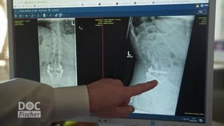 ein Arzt erklärt einer Patientin anhand einer Röntgenaufnahme einen erfolgten Eingriff an der Wirbelsäule
