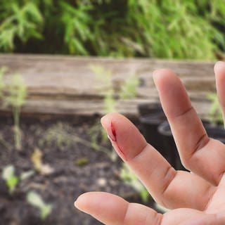 Eine Person hat sich in den Finger geschnitten. Im Hintergrund ein Gemüsebeet. Ein Kratzer auf der Haut durch Gartenarbeit, ein entzündlicher Mückenstich - selbst kleine Verletzungen können eine gefährliche Blutvergiftung, eine Sepsis, entwickeln.