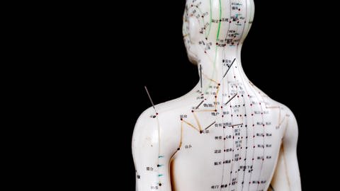 Ein Modelkörper steht mit dem Rücken zugewand zum Auge des Betrachters. Auf dem Körper und Kopf sind die Meridiane und Akupunkturpunkte abgebildet. In vereinzelten Punkten stecken Akupunkturnadeln.