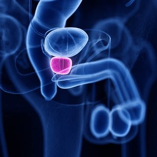 Prostatakrebs behandeln mithilfe der PSMA-Therapie? Darstellung inneren männlichen Geschlechtsorgane mit Markierung der Prostata zwischen Harnblase und dem Beckenboden - Darstellung ähnliches eines Röntgen-Bildes